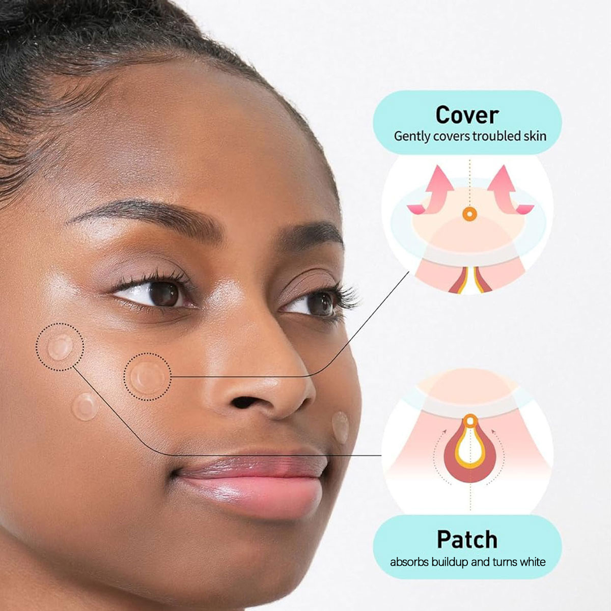 Olive Young Care Plus Spot Cov - đánh giá và giá Skincare Acne