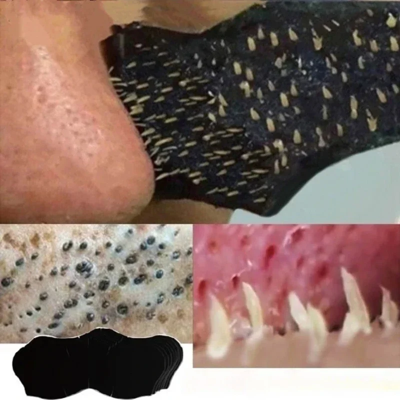 Unisex Blackhead Remove Mask N - đánh giá và giá Charcoal Pore Strip