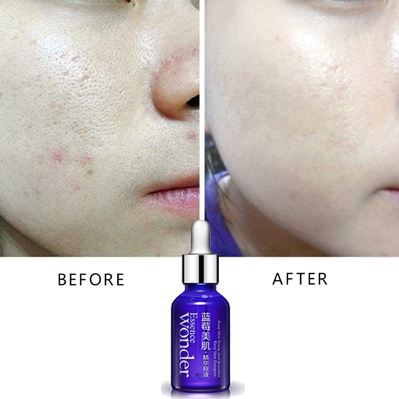BIOAQUA Việt Quất Mặt Nâng Huy - đánh giá và giá Skincare Bioaqua