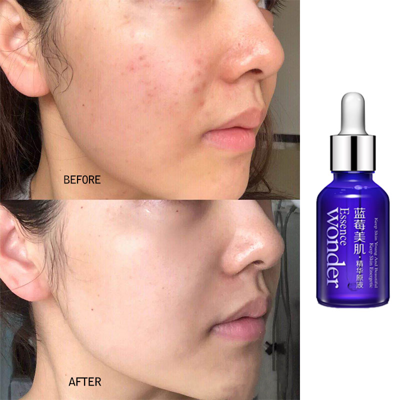 BIOAQUA Việt Quất Mặt Nâng Huy - đánh giá và giá Skincare Bioaqua