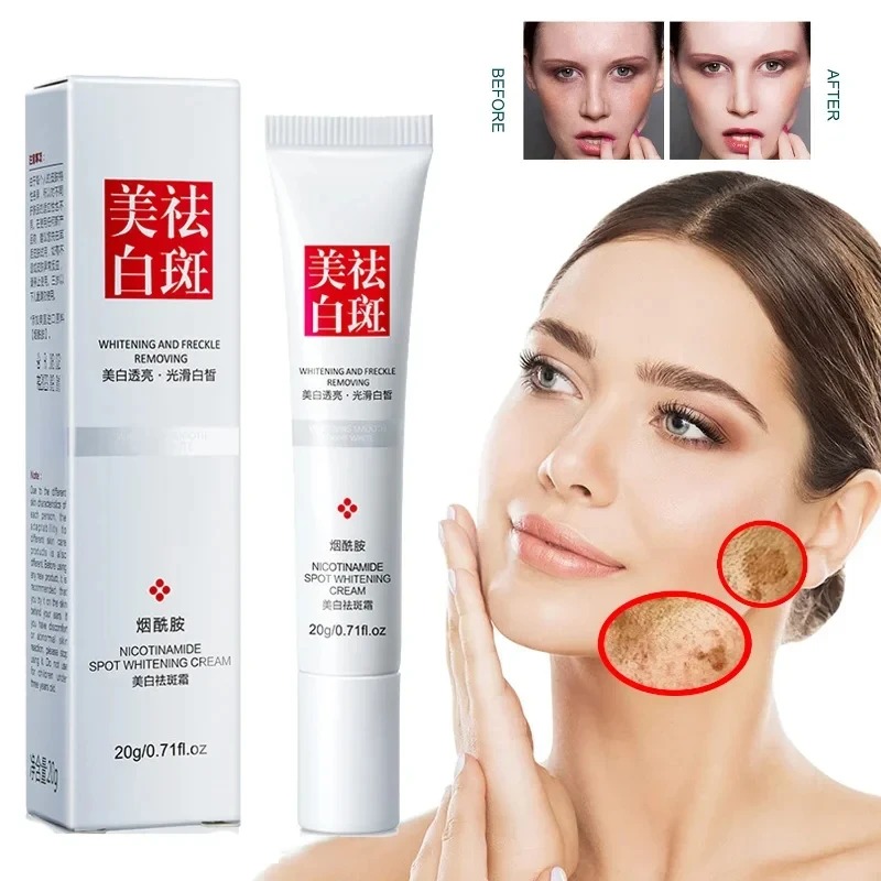 Fade and Improve Freckles Blac - đánh giá và giá Skincare Glow