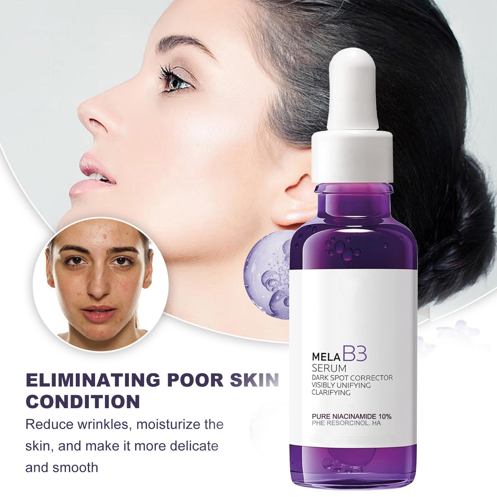 5in1 Rice Niacinamide VC Anti  - đánh giá và giá Skincare La Roche Posay