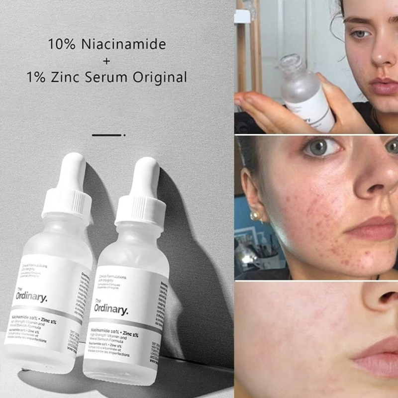 The Ordinary Niacinamide 10% + - đánh giá và giá Skincare La Roche Posay