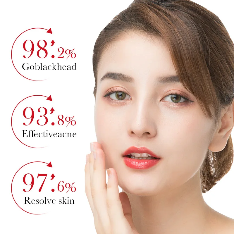 BIOAQUA Salicylic Acid Acne Re - đánh giá và giá Skincare Bioaqua