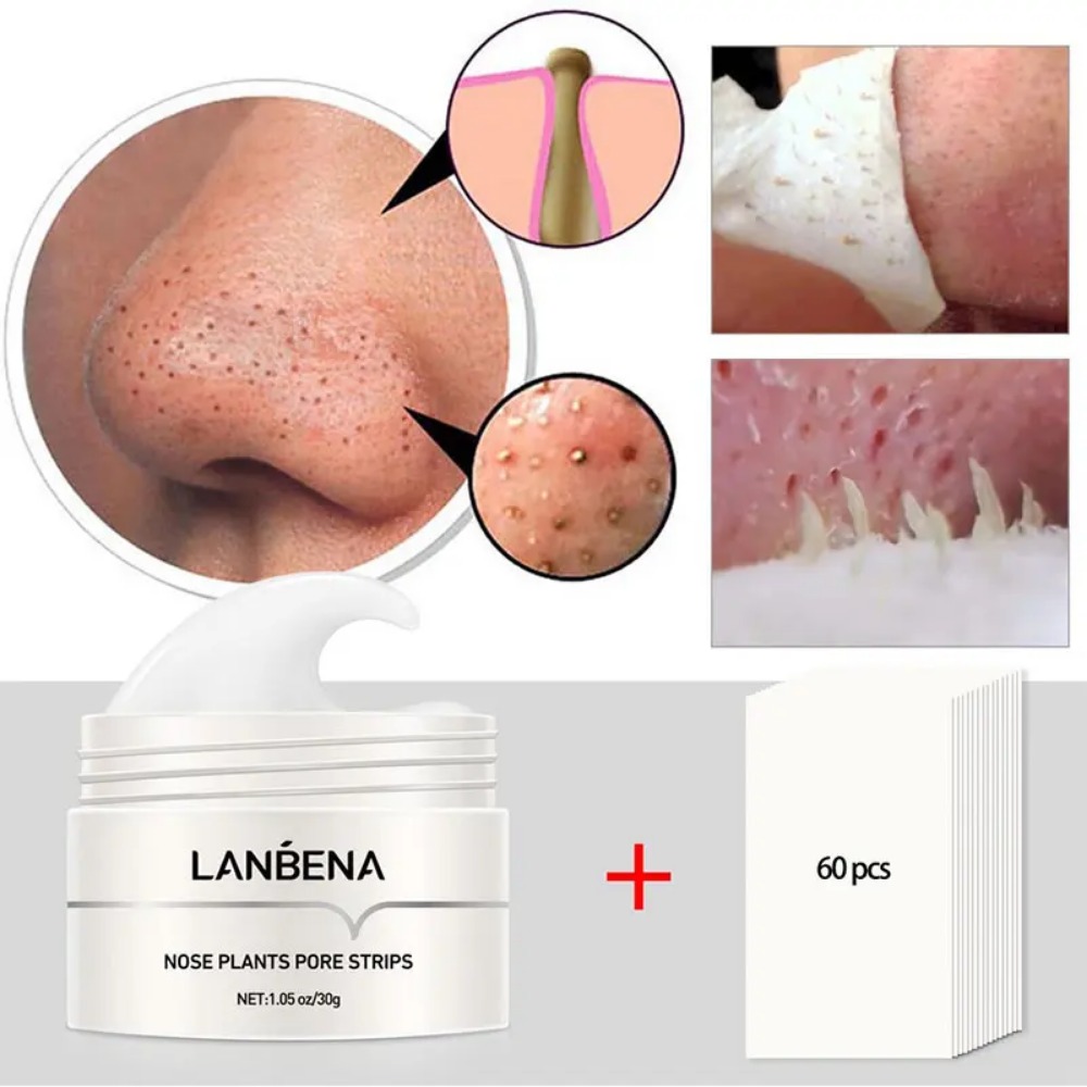 Nose Blackhead Remover Cream P - đánh giá và giá Charcoal Pore Strip