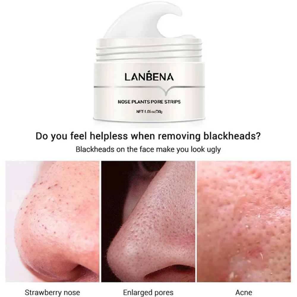 Nose Blackhead Remover Cream P - đánh giá và giá Charcoal Pore Strip