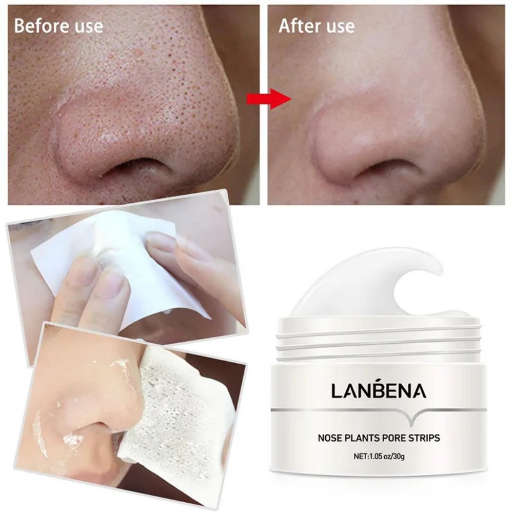 Nose Blackhead Remover Cream P - đánh giá và giá Charcoal Pore Strip