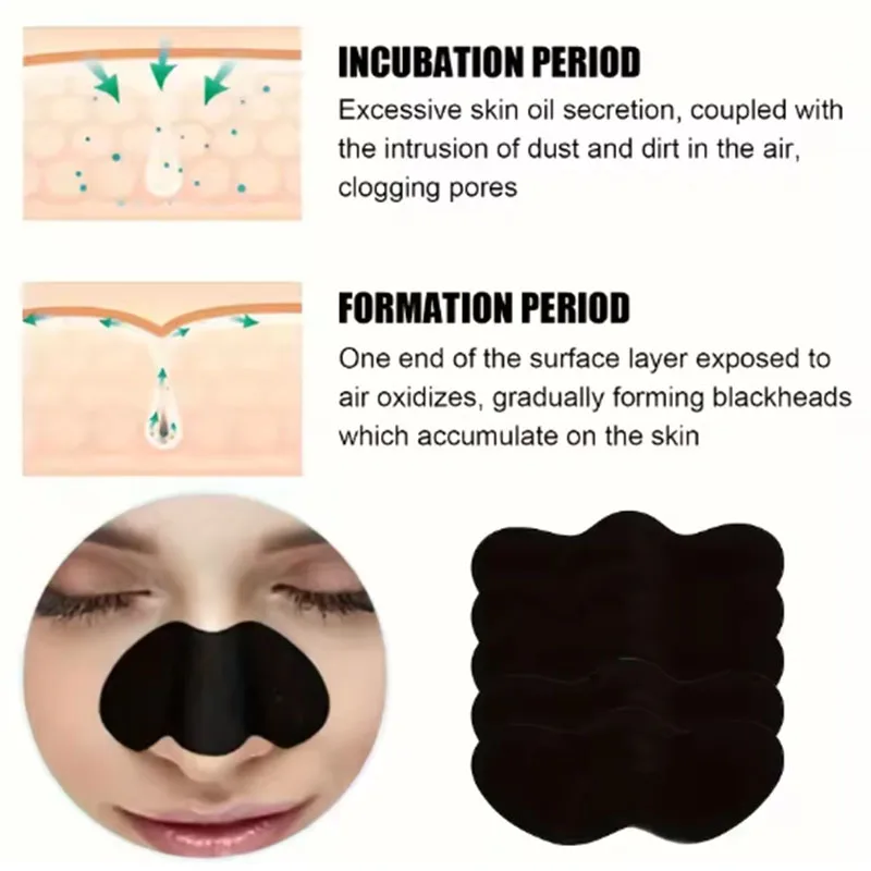 10/20/50Pcs Charcoal Blackhead - đánh giá và giá Charcoal Pore Strip