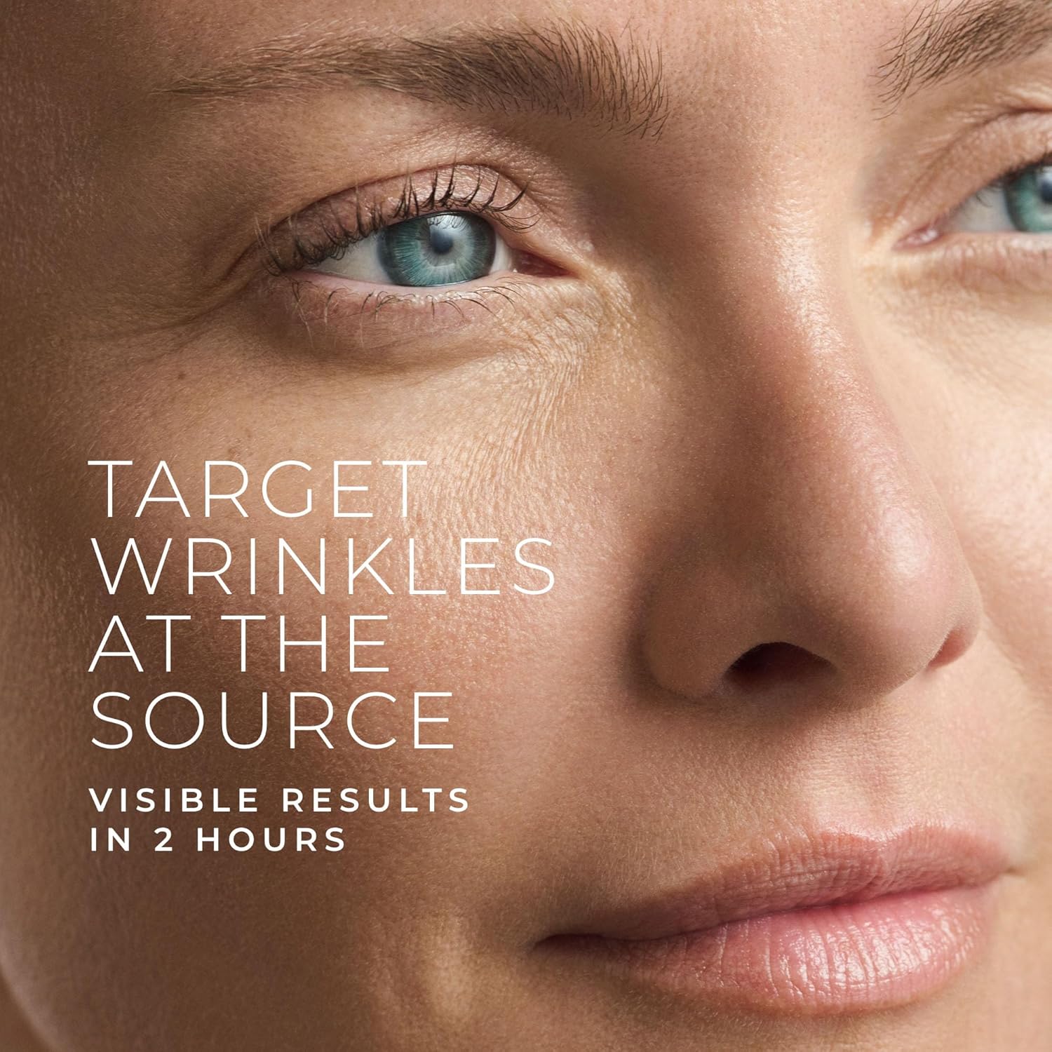 Hyaluronic Acid Retinol Micron - đánh giá và giá Skincare Acne